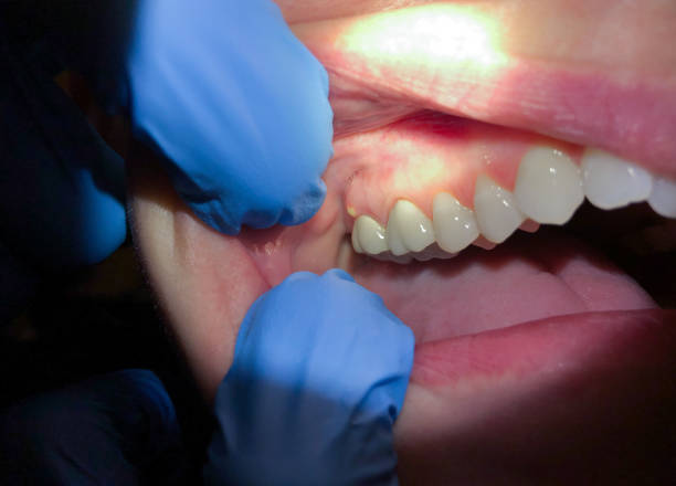 Best Dentist for Dental Trauma  in , TX