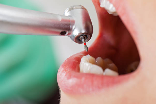 Best Cracked Tooth Emergency Dentist  in , TX